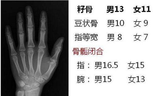 脊柱侧弯早发现 家庭自我筛查指南，守护您和孩子的脊梁健康